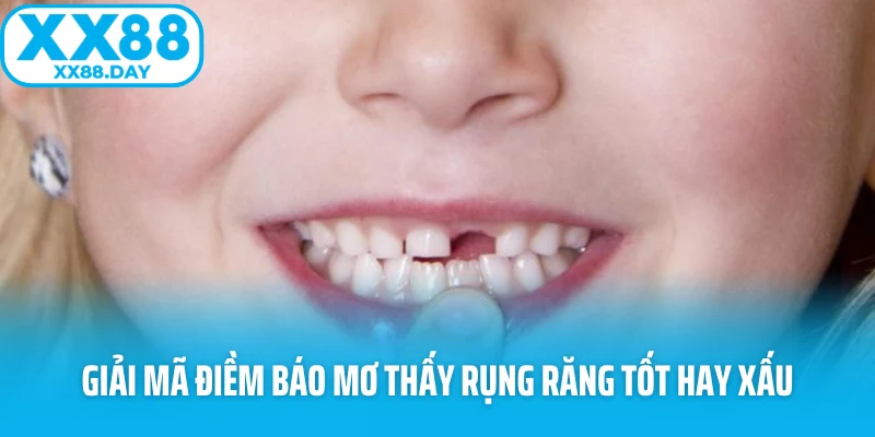Hé Lộ Bí Ẩn Sau Giấc Mơ Thấy Rụng Răng Khiến Ai Cũng Lo - spinbloom88